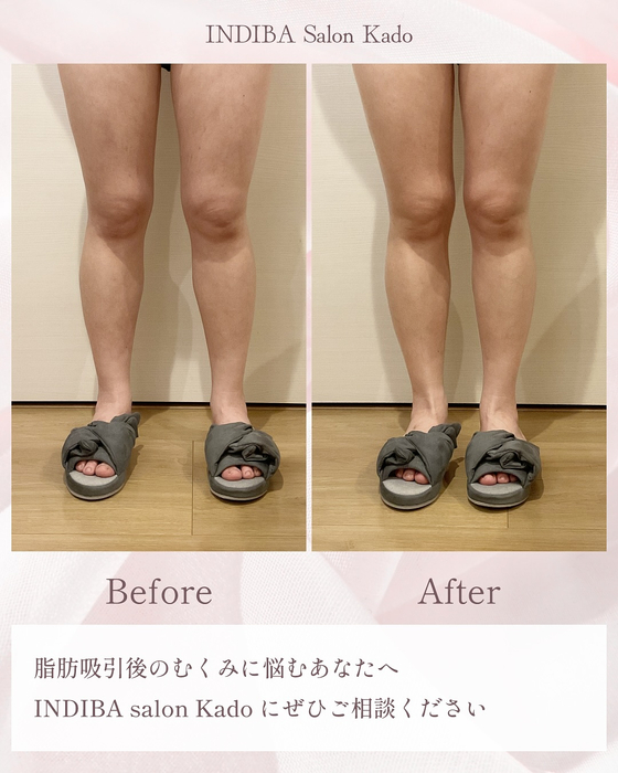 画像304