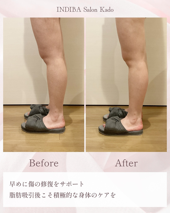 画像305